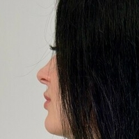 ann_mii Nua