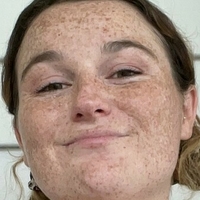 freckledbabyy Nua