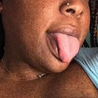 freckledfantasy5 Nua