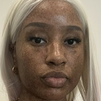 freckledn Nua