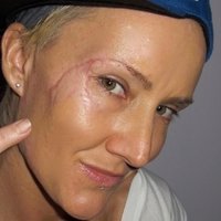Keala Kennelly Nua