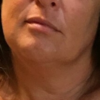 Lady Lara Nua