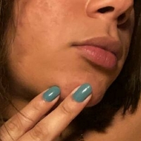 Melolo Nua