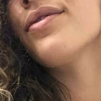 plscrycarmen Nua