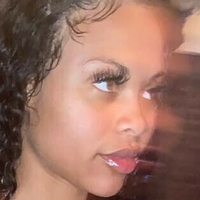 Rihannasforehead9 Nua