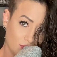 rocking_alopecia Nua