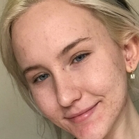 Trippi Miki Nua